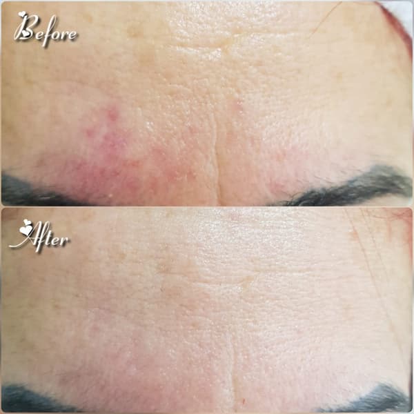 Nadire Güzellik Salonu - 32. Fotoğraf Nadire Güzellik Salonu - 32. Fotoğraf