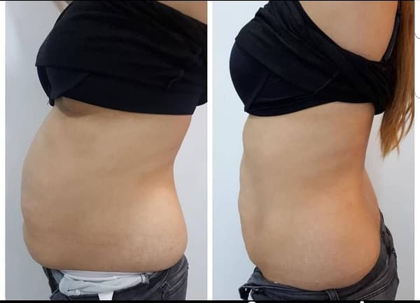 Nadire Güzellik Salonu - 57. Fotoğraf Nadire Güzellik Salonu - 57. Fotoğraf