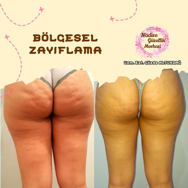 Nadire Güzellik Salonu - 65. Fotoğraf