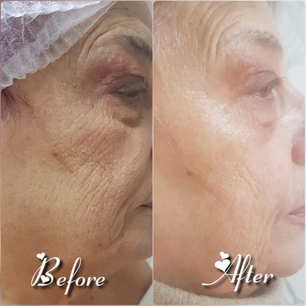 Nadire Güzellik Salonu - 26. Fotoğraf Nadire Güzellik Salonu - 26. Fotoğraf