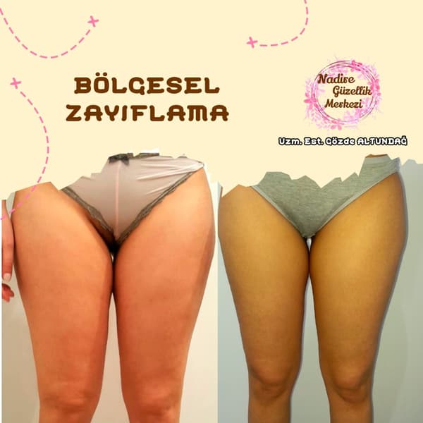 Nadire Güzellik Salonu - 67. Fotoğraf