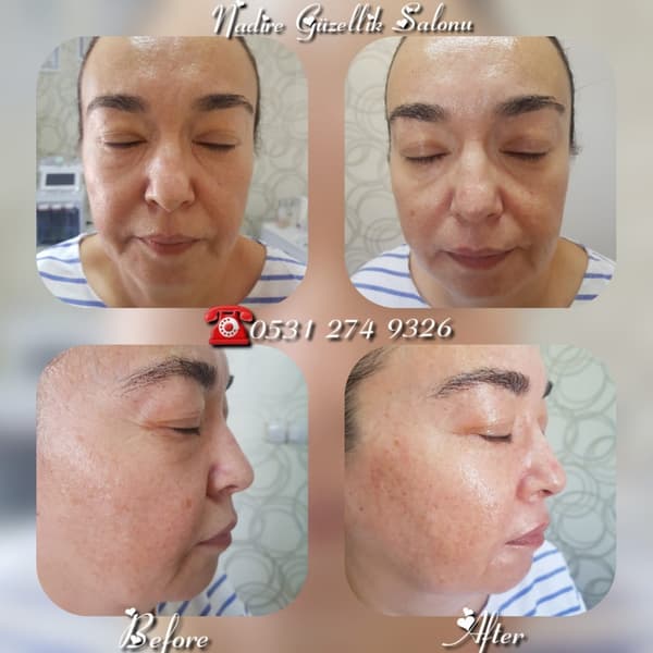 Nadire Güzellik Salonu - 24. Fotoğraf