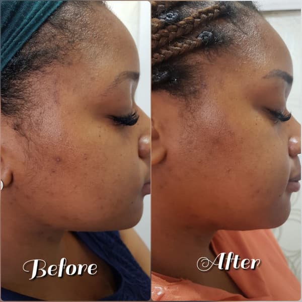 Nadire Güzellik Salonu - 25. Fotoğraf Nadire Güzellik Salonu - 25. Fotoğraf