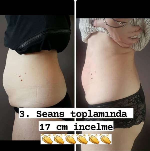 Nadire Güzellik Salonu - 56. Fotoğraf Nadire Güzellik Salonu - 56. Fotoğraf