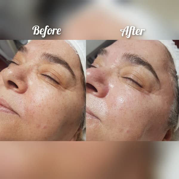 Nadire Güzellik Salonu - 21. Fotoğraf Nadire Güzellik Salonu - 21. Fotoğraf