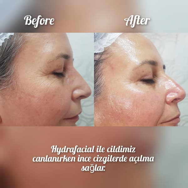 Nadire Güzellik Salonu - 18. Fotoğraf Nadire Güzellik Salonu - 18. Fotoğraf