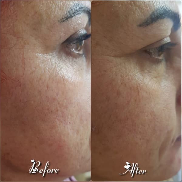 Nadire Güzellik Salonu - 33. Fotoğraf Nadire Güzellik Salonu - 33. Fotoğraf