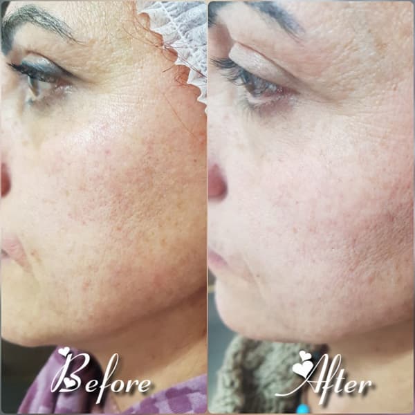 Nadire Güzellik Salonu - 31. Fotoğraf Nadire Güzellik Salonu - 31. Fotoğraf