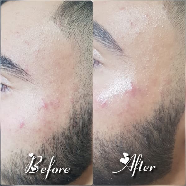 Nadire Güzellik Salonu - 39. Fotoğraf Nadire Güzellik Salonu - 39. Fotoğraf