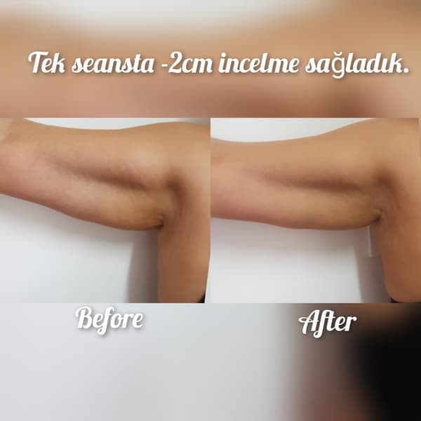 Nadire Güzellik Salonu - 7. Fotoğraf