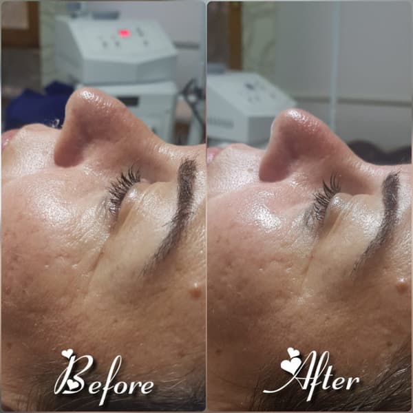 Nadire Güzellik Salonu - 34. Fotoğraf Nadire Güzellik Salonu - 34. Fotoğraf