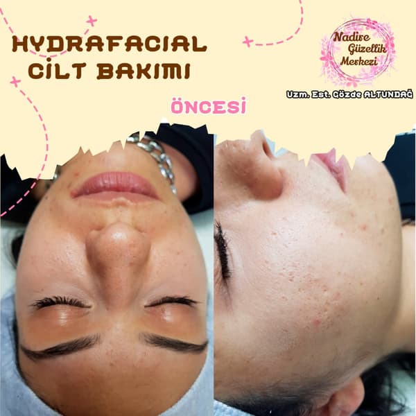 Nadire Güzellik Salonu - 64. Fotoğraf Nadire Güzellik Salonu - 64. Fotoğraf