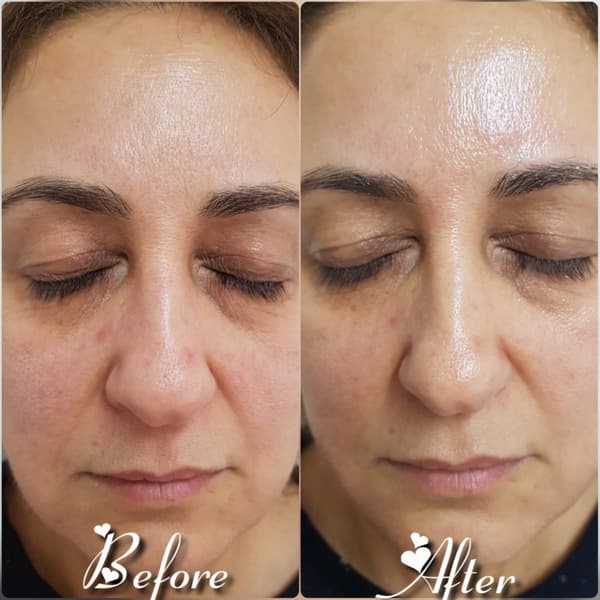 Nadire Güzellik Salonu - 28. Fotoğraf Nadire Güzellik Salonu - 28. Fotoğraf