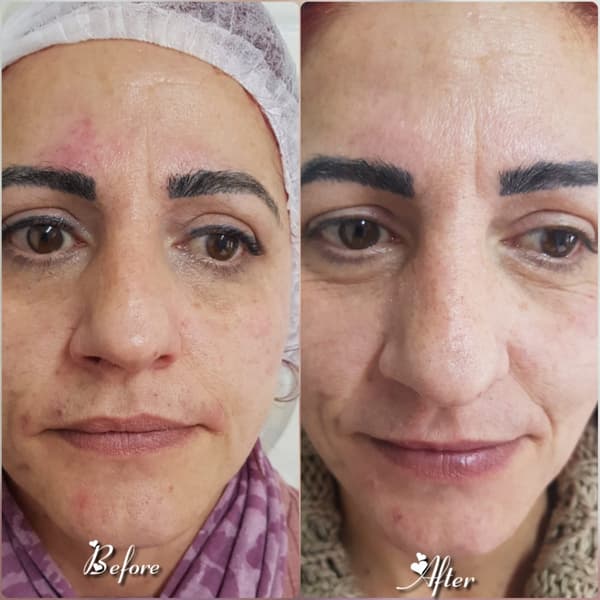 Nadire Güzellik Salonu - 30. Fotoğraf Nadire Güzellik Salonu - 30. Fotoğraf