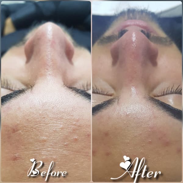 Nadire Güzellik Salonu - 42. Fotoğraf Nadire Güzellik Salonu - 42. Fotoğraf