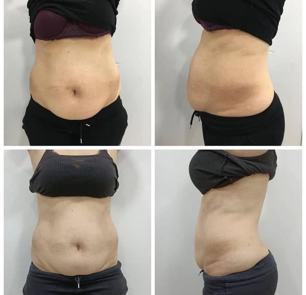 Nadire Güzellik Salonu - 55. Fotoğraf Nadire Güzellik Salonu - 55. Fotoğraf