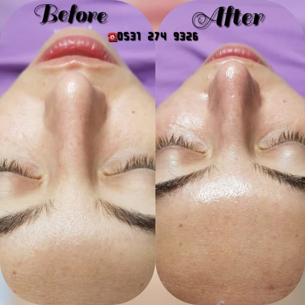 Nadire Güzellik Salonu - 19. Fotoğraf Nadire Güzellik Salonu - 19. Fotoğraf