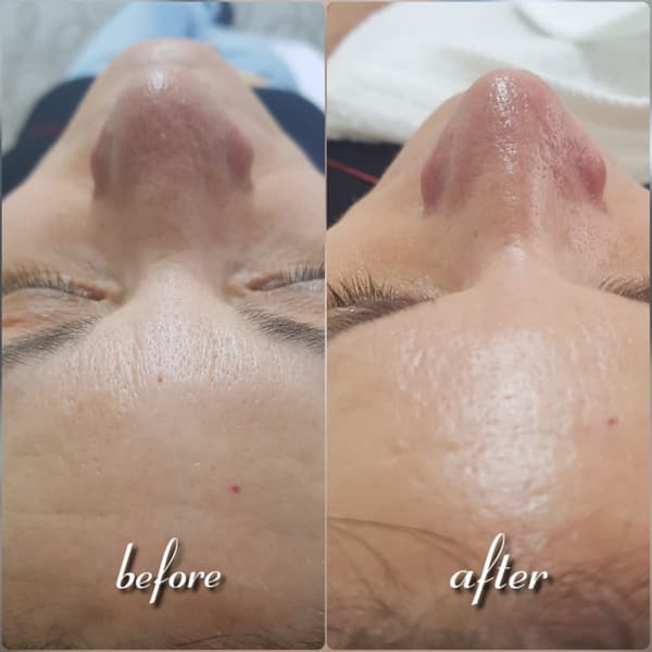 Nadire Güzellik Salonu - 40. Fotoğraf Nadire Güzellik Salonu - 40. Fotoğraf